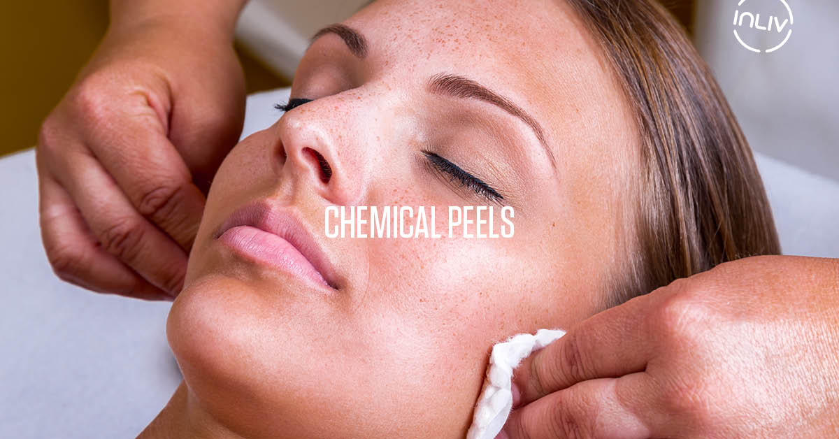 Chemical Peels, Skin Peels, Face Peels - INLIV Calgary